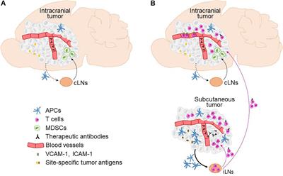 Immune Checkpoint Blockade – How Does It Work in Brain Metastases?